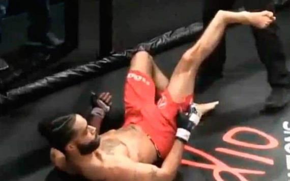 VIDEO: Esta es la terrible fractura de un luchador de MMA