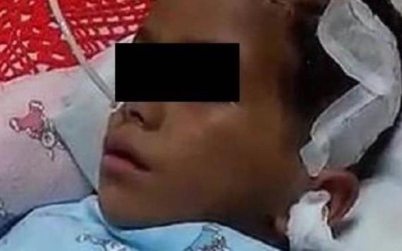 Isaac de 7 años requiere ayuda humanitaria, sufre un tumor maligno en su cabeza