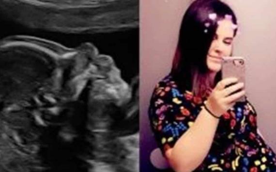 Joven embarazada se lleva el susto de su vida al ver el ultrasonido de su bebé 