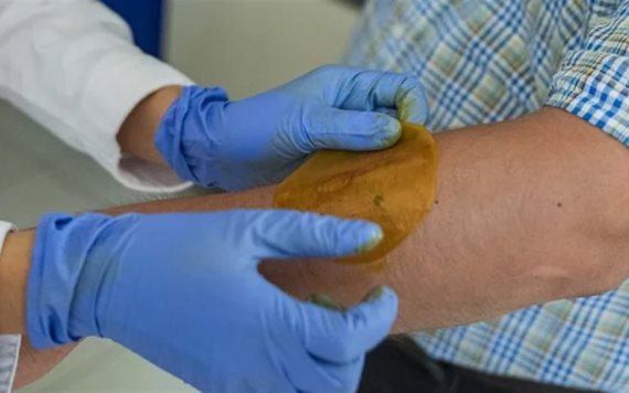 Crean parche que regenera piel de diabéticos en 21 días