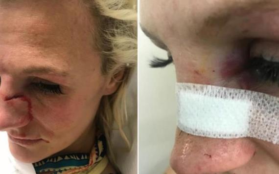 Peleadora de MMA es golpeada por su novio por querer terminar con él