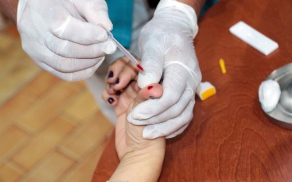 Aumentan en México los casos de VIH en jóvenes de 15 a 29 años