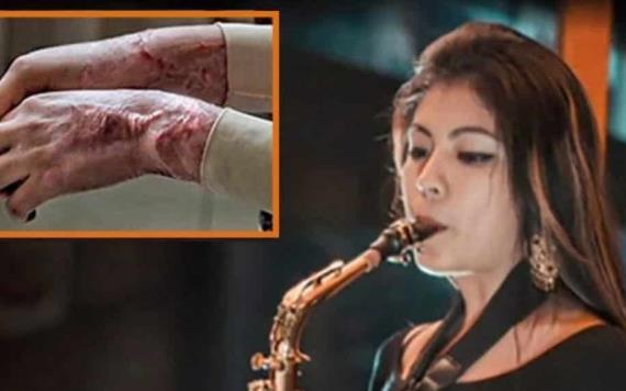 Saxofonista quemada con ácido da sus primeras declaraciones