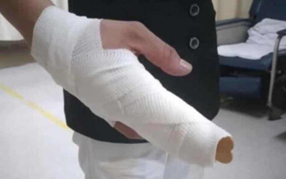 Le fracturan dos dedos a una enfermera en San Luis Potosí; la atacaron por temor al COVID-19