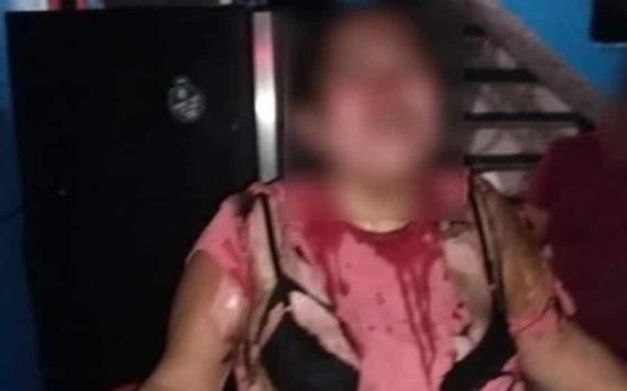 Hombre rocío con alcohol a su esposa y le prendió fuego, hechos ocurridos en Gaviotas Norte