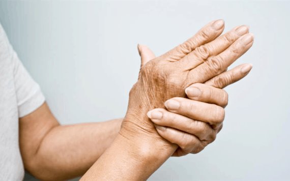 Consejos para limitar los dolores causados por la Artritis