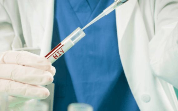 Estudio revela que vacuna experimental evita transmisión del VIH en mujeres