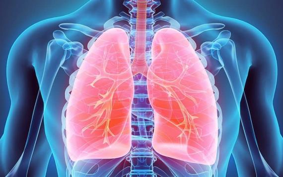 COVID-19 podría causar anomalías pulmonares meses después del contagio