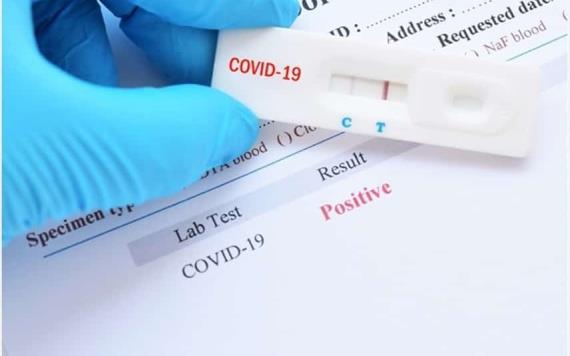 Se harán pruebas de Covid-19 gratis en farmacias y centros comerciales