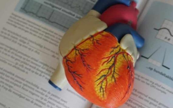 Síndrome de corazón roto puede ser causado por estrés y alta actividad cerebral