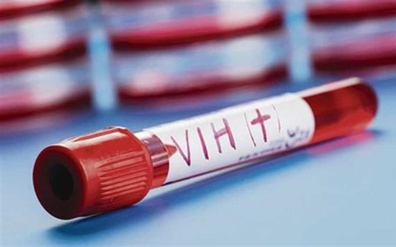 Detectan más casos de VIH en Tabasco 