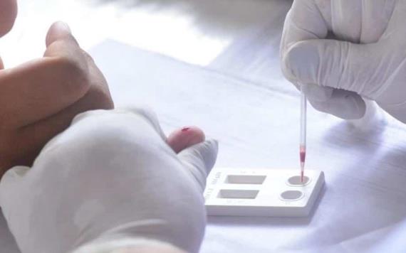 12 personas resultaron positivos a VIH durante aplicación de pruebas rápidas