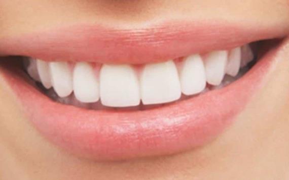 Alimentos que ayudan a blanquear los dientes de forma natural