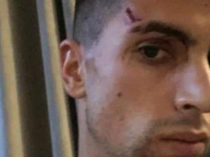 Hieren a jugador del Manchester City en violento robo en su casa Hieren a jugador del Manchester City en violento robo en su casa