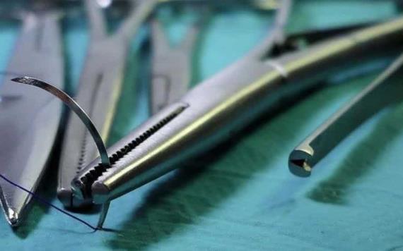 Mujer vivió 20 años con tijeras en su abdomen; fue olvidada por médicos tras cirugía
