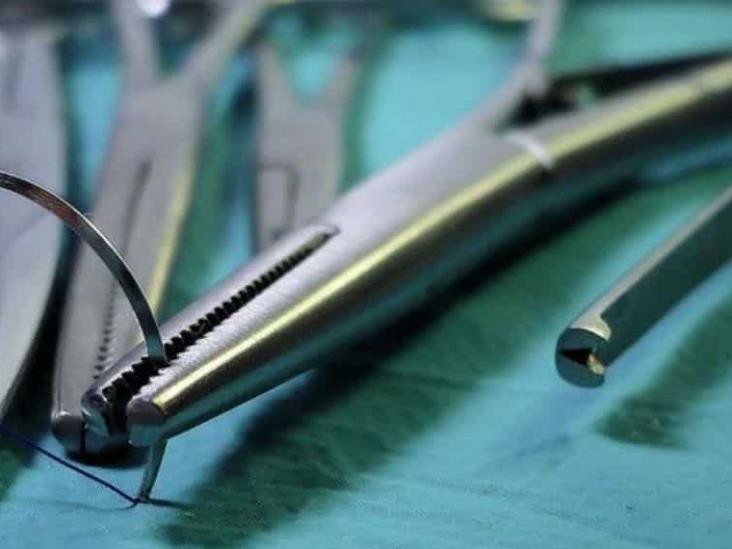Mujer vivió 20 años con tijeras en su abdomen; fue olvidada por médicos tras cirugía Mujer vivió 20 años con tijeras en su abdomen; fue olvidada por médicos tras cirugía