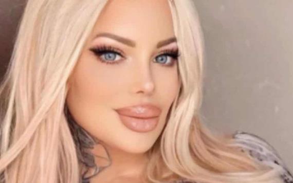 Sabrina Sabrok pierde parcialmente la movilidad de su rostro tras uso de bótox