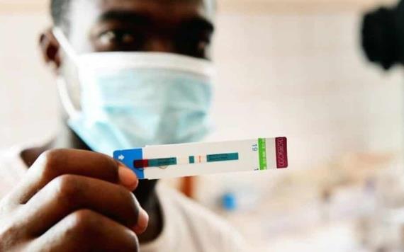 Descubren variante del VIH más transmisible y dañina