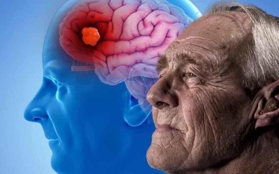Estos son algunos mitos comunes sobre el Alzheimer que son falsos
