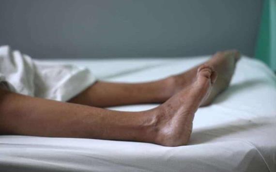 Síndrome de Guillain-Barré primera causa de parálisis flácida aguda en hospitales de México