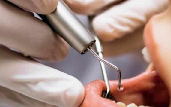 Dentista dañaba los dientes de sus pacientes para seguir atendiéndolos