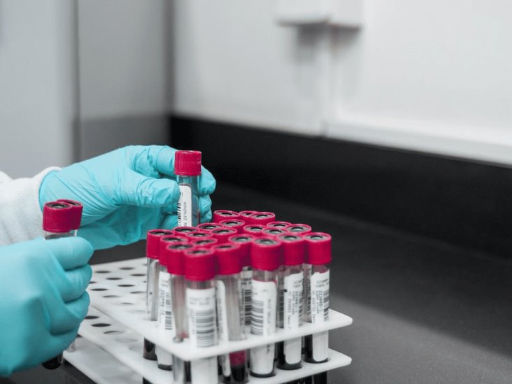 Reino Unido reporta infecciones diarias por viruela del mono Reino Unido reporta infecciones diarias por viruela del mono