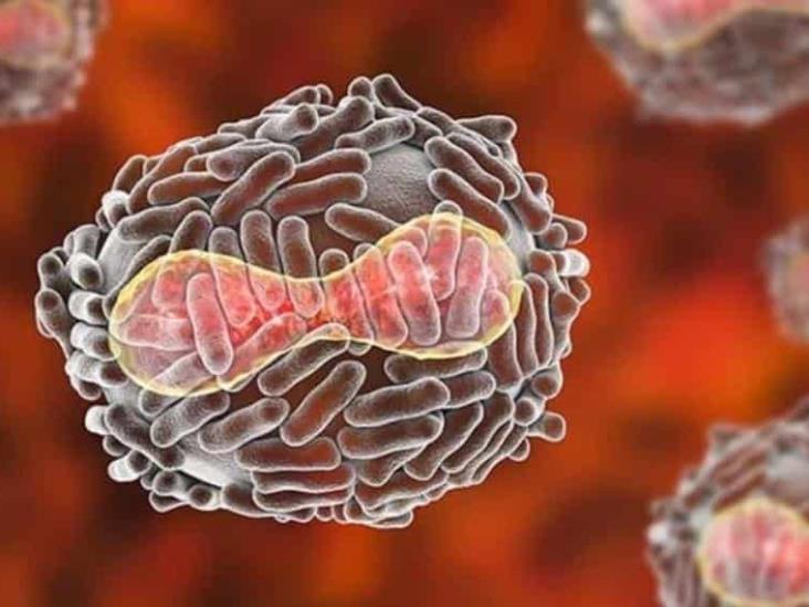 Viruela del mono: ¿Nueva pandemia? Qué es y cómo se transmite Viruela del mono: ¿Nueva pandemia? Qué es y cómo se transmite