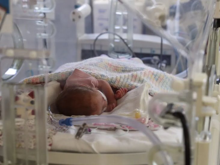 Bebé cae de cabeza al salir del vientre de su mamá en Brasil Bebé cae de cabeza al salir del vientre de su mamá en Brasil