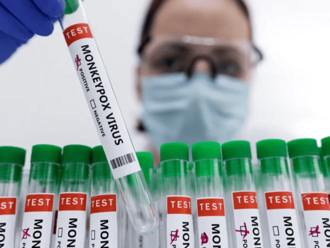 OMS descarta vacunación masiva contra la viruela del mono OMS descarta vacunación masiva contra la viruela del mono