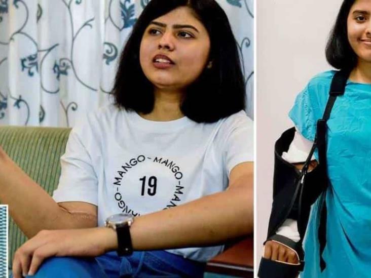 Mujer es amputada y recibe trasplante de brazos masculinos en India Mujer es amputada y recibe trasplante de brazos masculinos en India