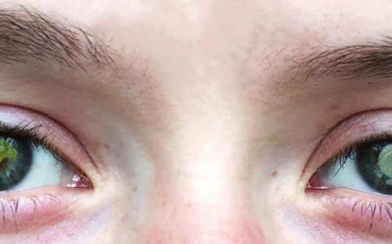 Los ojos podrían ser importantes para diagnosticar autismo y TDAH, revela estudio
