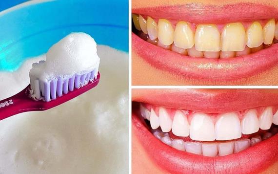 ¿Quieres dientes blancos? Cuidado con los remedios caseros