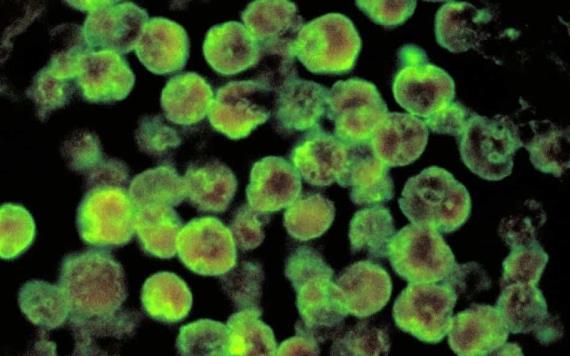 Niño muere de infección por ameba comecerebros en Nebraska