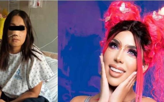 Yeri Mua regalará cirugía estética de nariz a mujer agredida en Veracruz