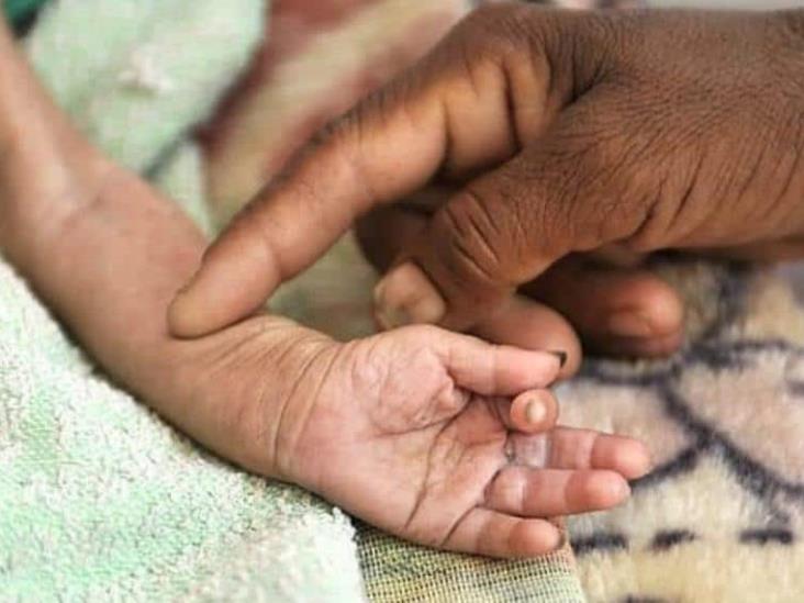 OMS advierte sobre brote de cólera y desnutrición infantil en Siria OMS advierte sobre brote de cólera y desnutrición infantil en Siria