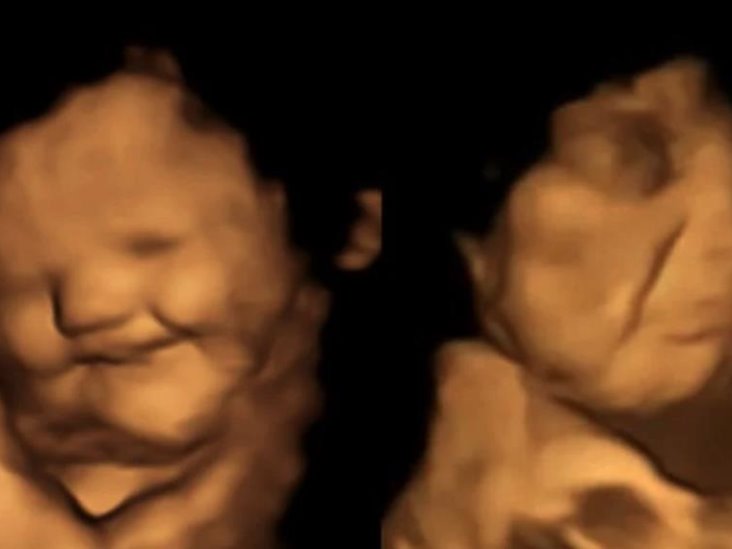 Investigación confirmó que los fetos pueden sentir gustos durante la gestación Investigación confirmó que los fetos pueden sentir gustos durante la gestación