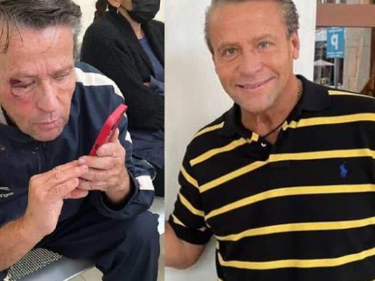 Alfredo Adame es golpeado afuera de su casa; tiene posible desprendimiento de retina Alfredo Adame es golpeado afuera de su casa; tiene posible desprendimiento de retina