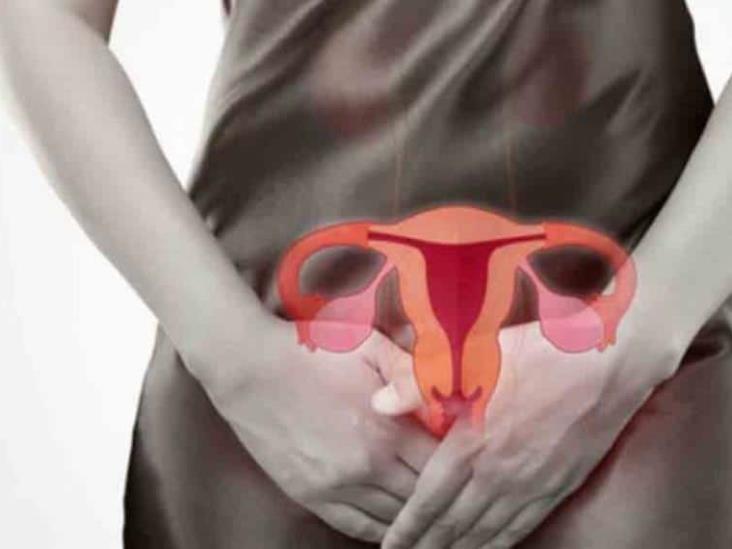 Síntomas de cáncer de ovario que las mujeres suelen ignorar Síntomas de cáncer de ovario que las mujeres suelen ignorar