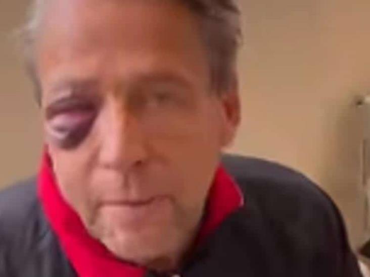 Alfredo Adame confirma que necesita cirugía por fracturas tras brutal golpiza Alfredo Adame confirma que necesita cirugía por fracturas tras brutal golpiza