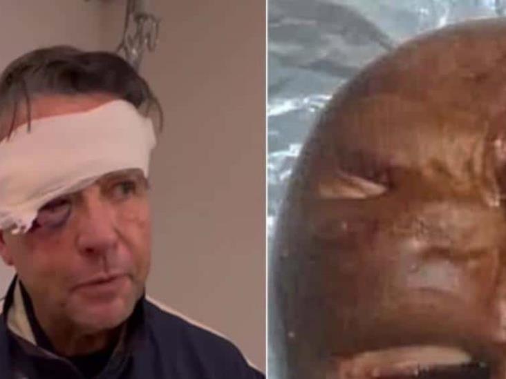 ´Chale, se pasan banda´, dijo Alfredo Adame del pan de su cara deformada por una golpiza ´Chale, se pasan banda´, dijo Alfredo Adame del pan de su cara deformada por una golpiza