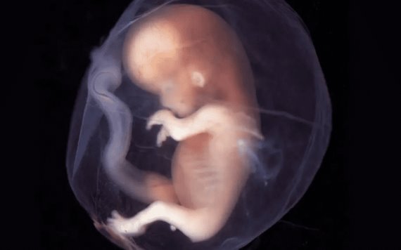 Fetos humanos acumulan contaminación en cerebro y pulmones desde el embarazo