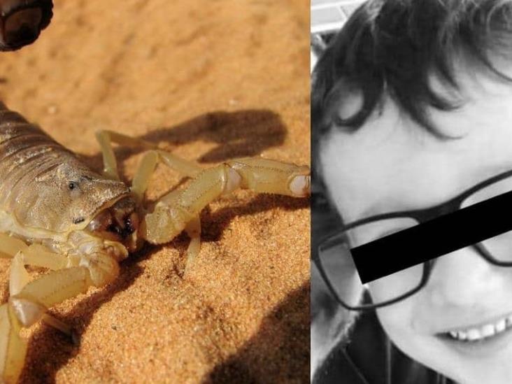 Niño sufrió siete infartos tras ser picado por un escorpión Niño sufrió siete infartos tras ser picado por un escorpión