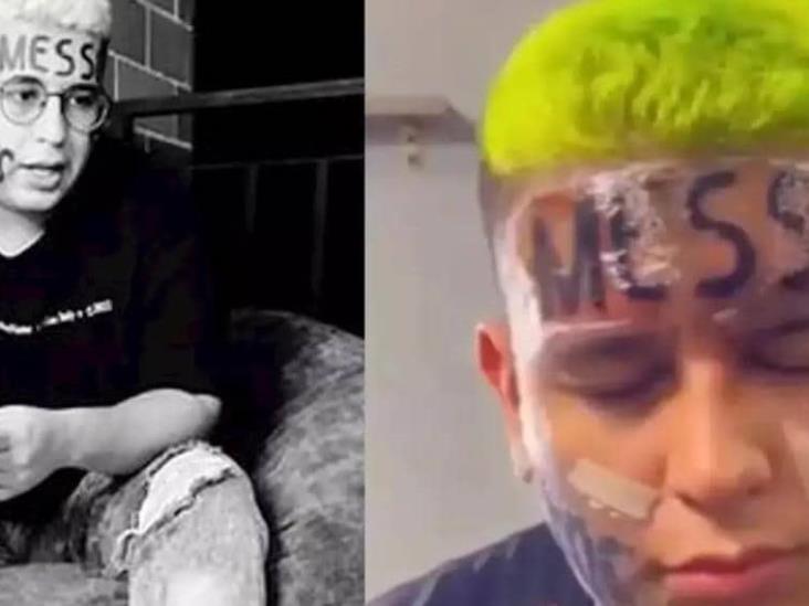 Joven se tatuó Messi en la frente y ahora se arrepiente: Necesito ayuda para borrarme el tatuaje Joven se tatuó Messi en la frente y ahora se arrepiente: Necesito ayuda para borrarme el tatuaje