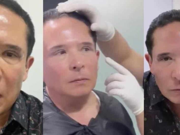 Gustavo Adolfo Infante se sometió a una cirugía estética; así luce tras la intervención Gustavo Adolfo Infante se sometió a una cirugía estética; así luce tras la intervención