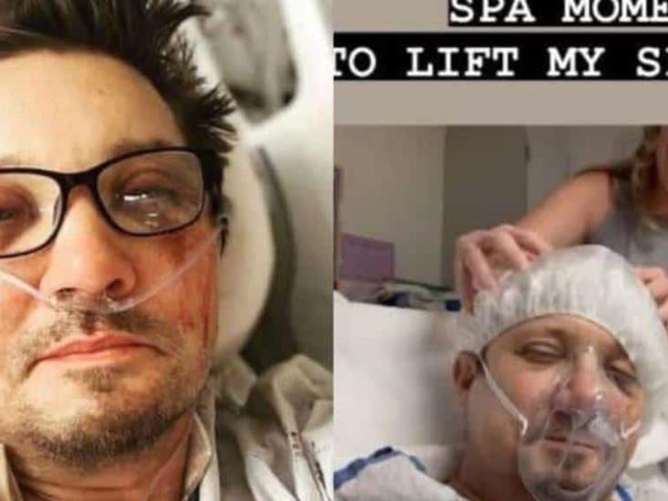Jeremy Renner mejora tras accidente y hasta lo consienten con spa Jeremy Renner mejora tras accidente y hasta lo consienten con spa