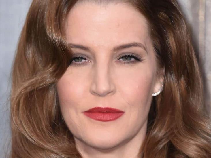 Esta fue la causa exacta de la muerte de Lisa Marie, la hija de Elvis Presley Esta fue la causa exacta de la muerte de Lisa Marie, la hija de Elvis Presley