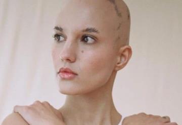 De Karely Ruiz a Camila Solórzano, famosas con alopecia que rompen estereotipos