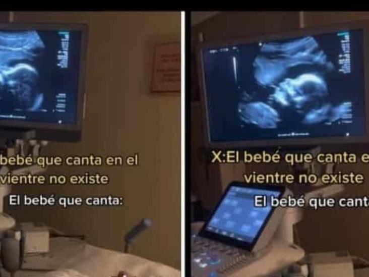 Video: Bebé canta en el vientre de su madre durante ultrasonido Video: Bebé canta en el vientre de su madre durante ultrasonido