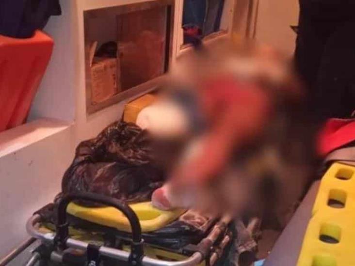 Joven acaba sin una pierna al caer en un molino Joven acaba sin una pierna al caer en un molino