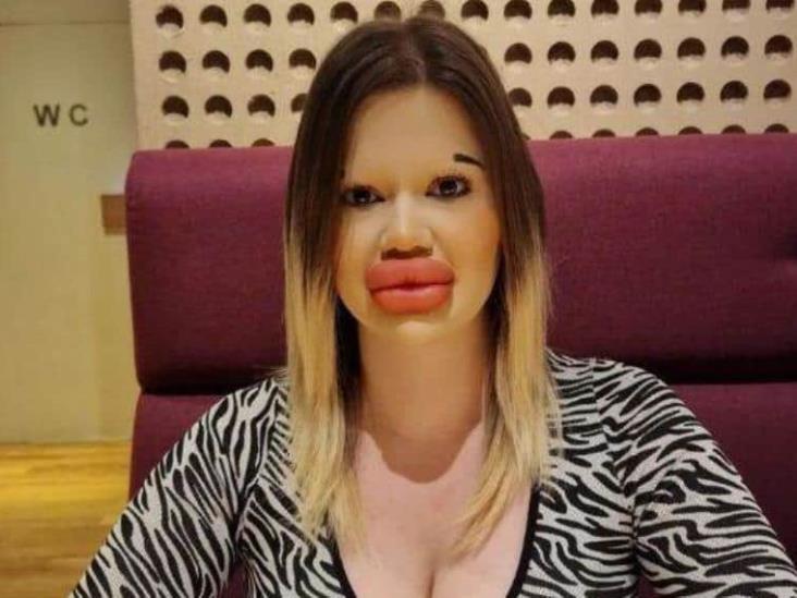 Esta influencer tiene los labios más grandes del mundo Esta influencer tiene los labios más grandes del mundo